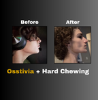 Osstivia SNEDDS Pre-Ordering