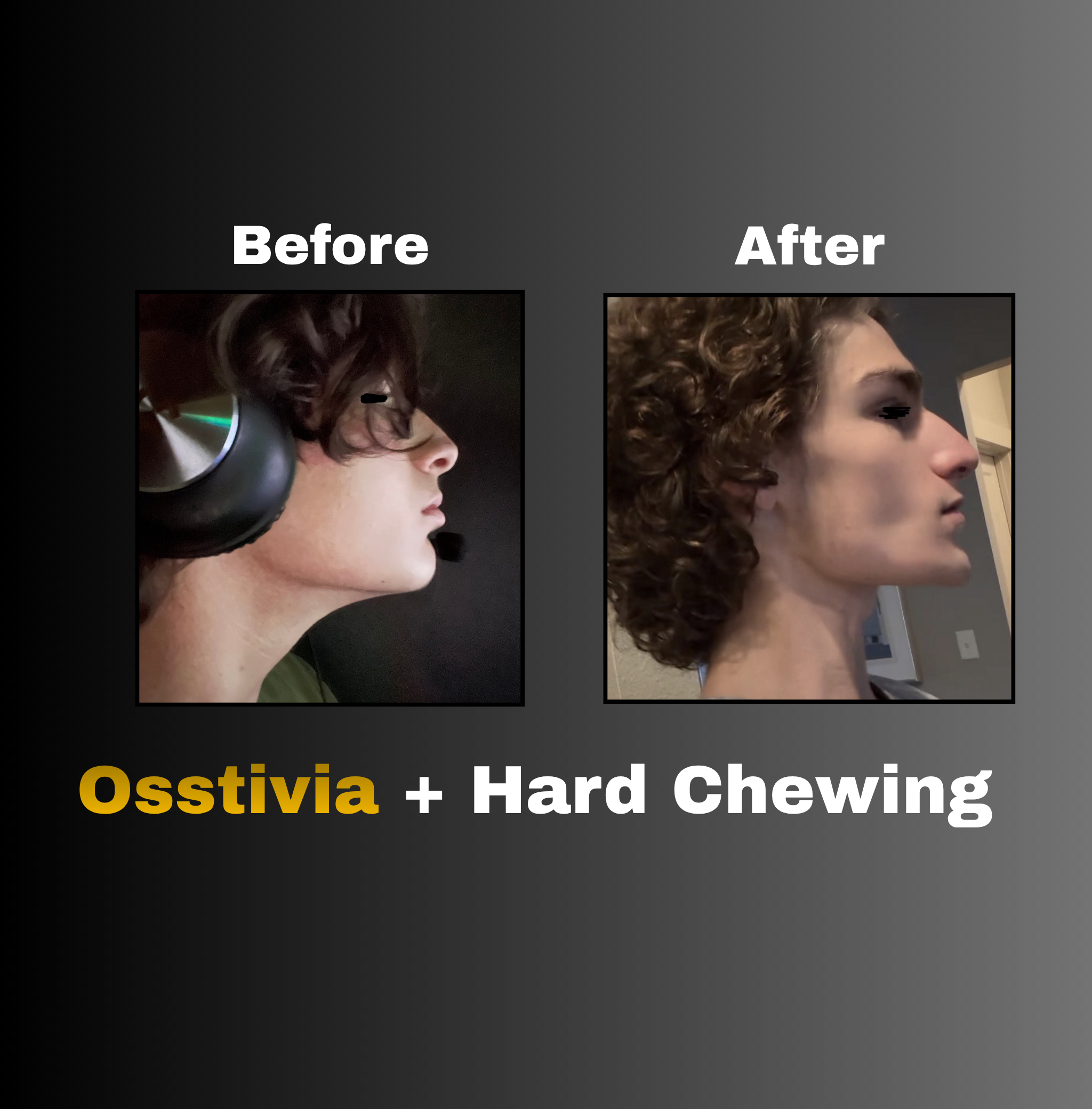 Osstivia SNEDDS
