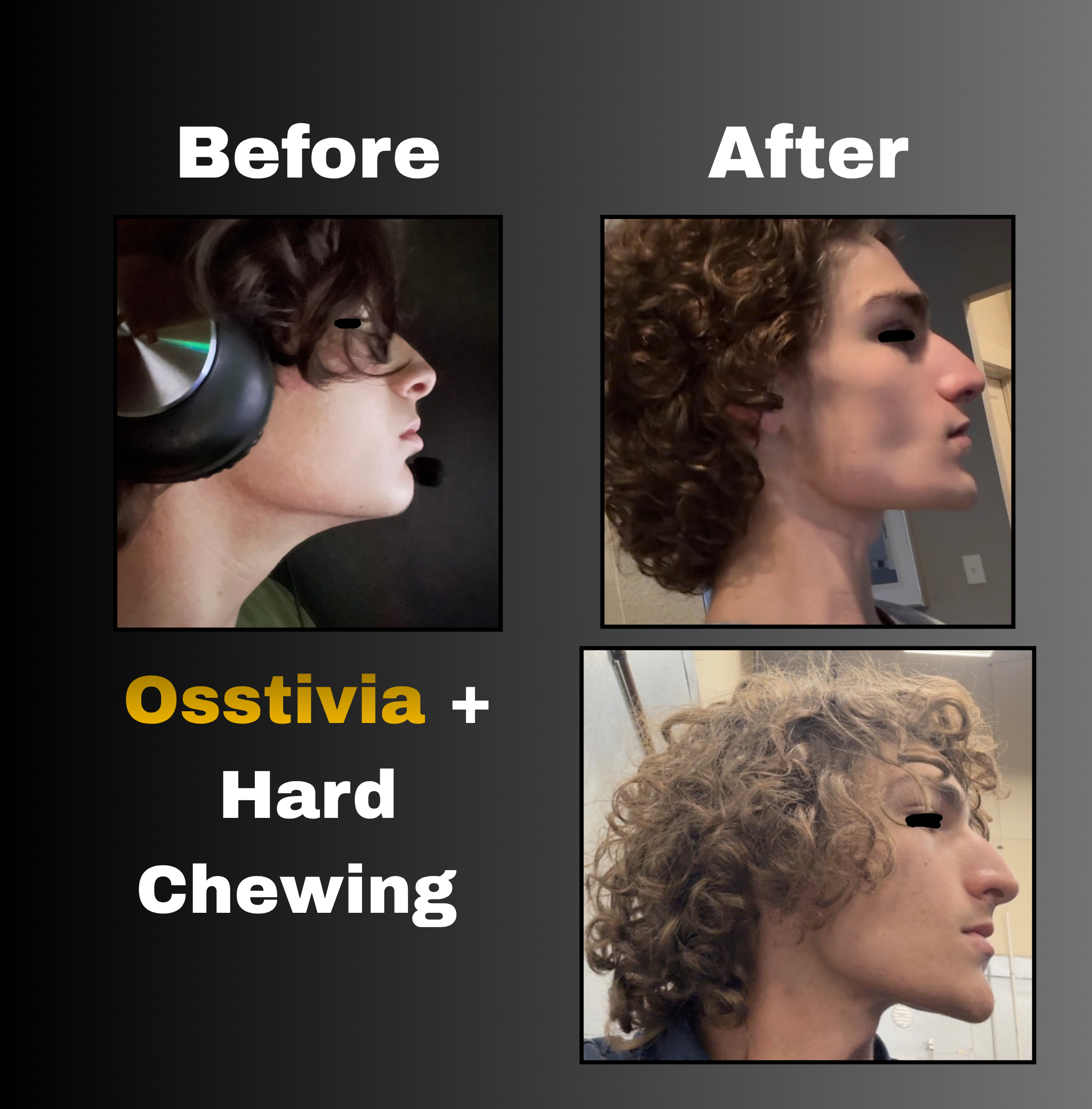 Osstivia SNEDDS Pre-Ordering