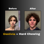 Osstivia SNEDDS Pre-Ordering