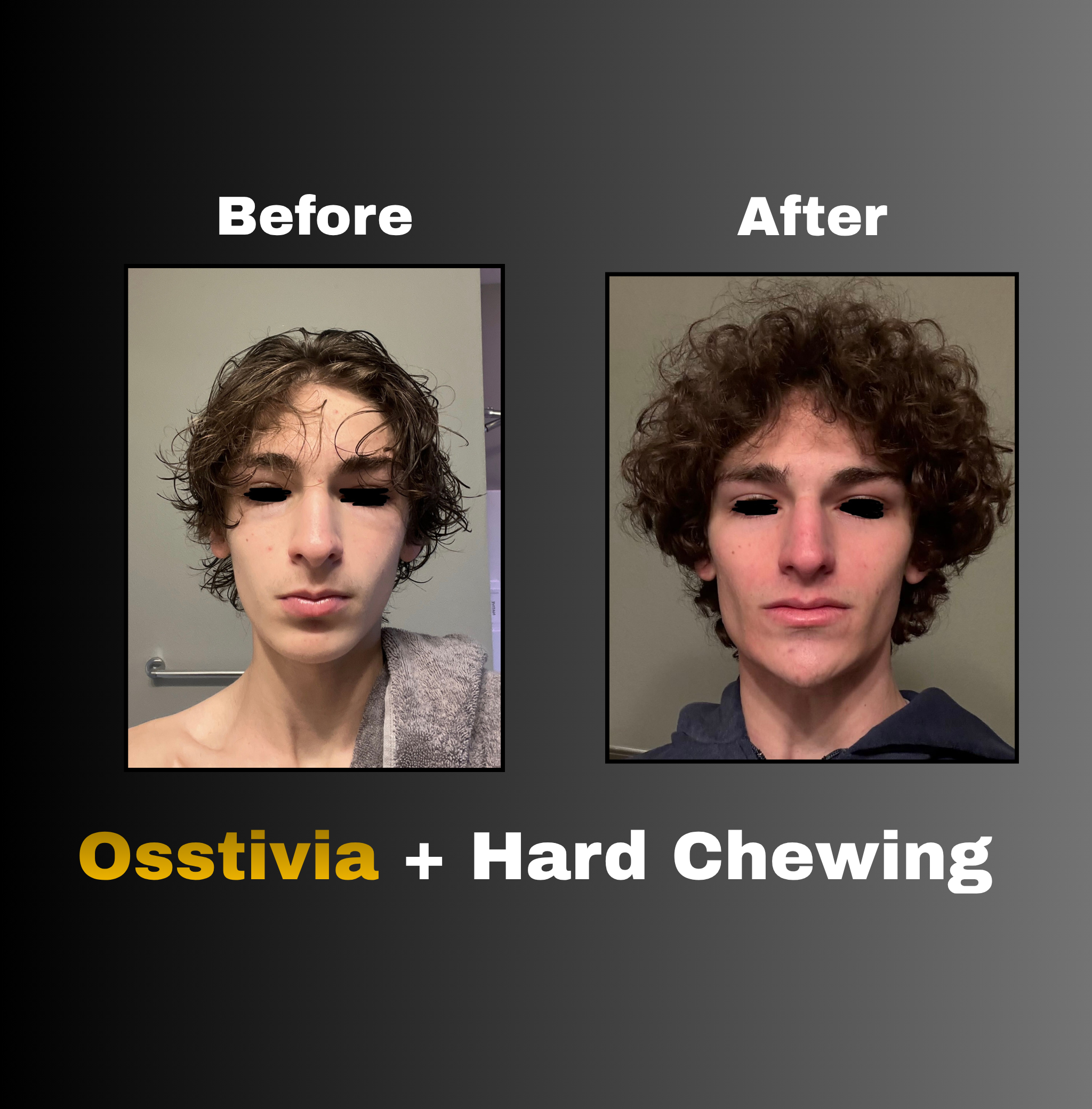 Osstivia SNEDDS Pre-Ordering