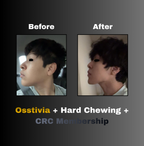 Osstivia SNEDDS Pre-Ordering