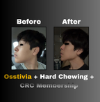 Osstivia SNEDDS Pre-Ordering