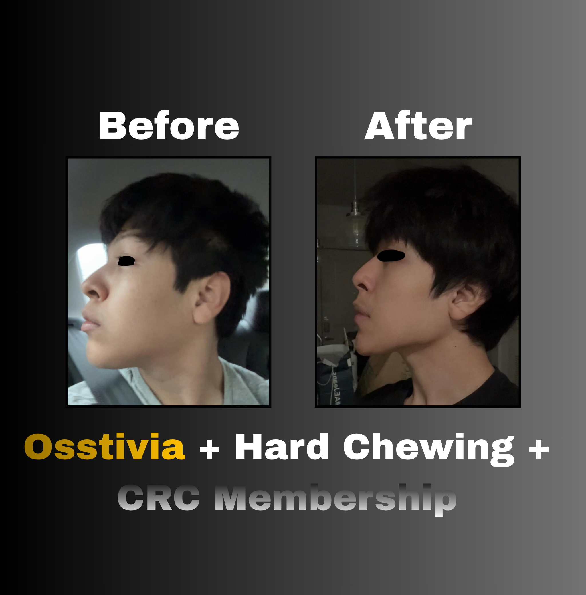 Osstivia SNEDDS Pre-Ordering