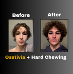 Osstivia SNEDDS Pre-Ordering