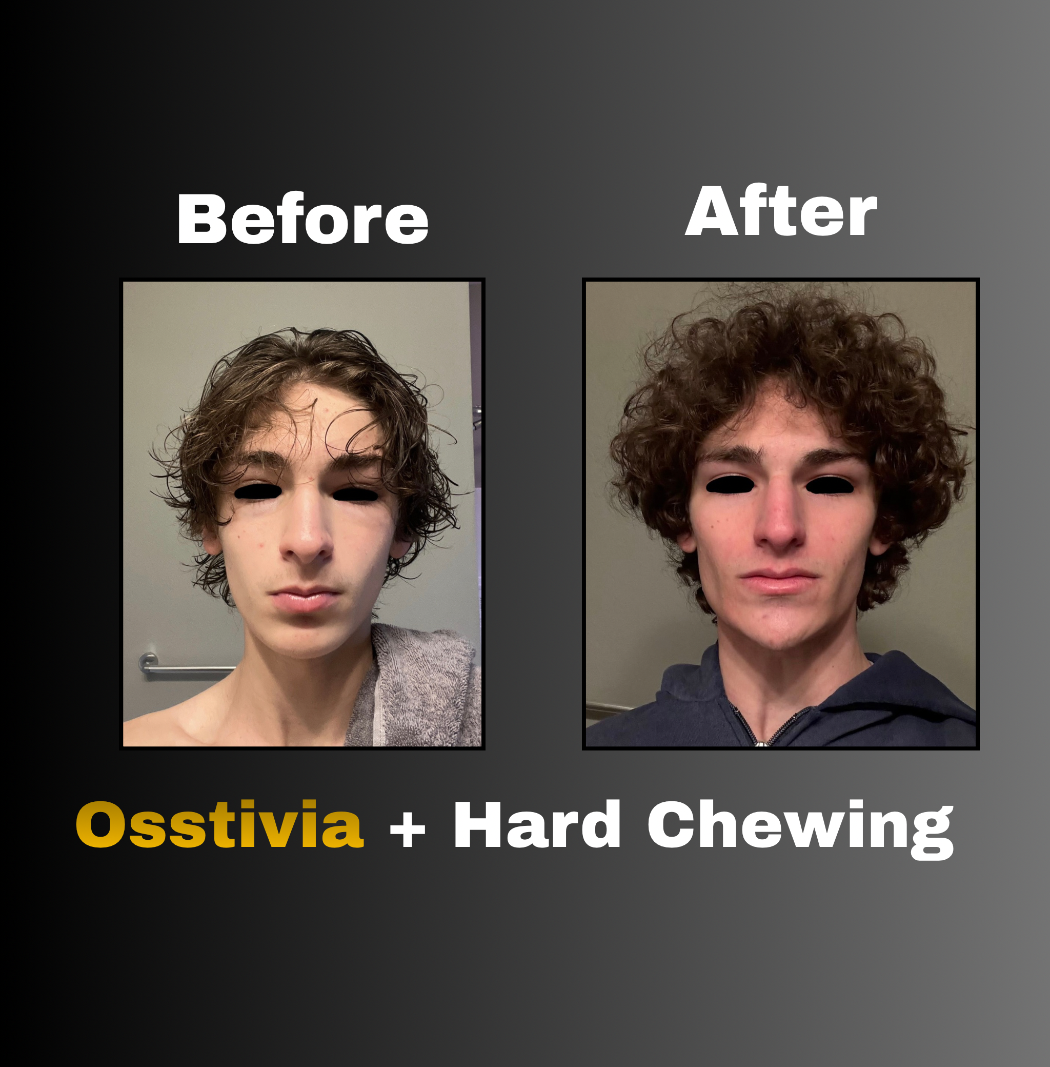 Osstivia SNEDDS Pre-Ordering