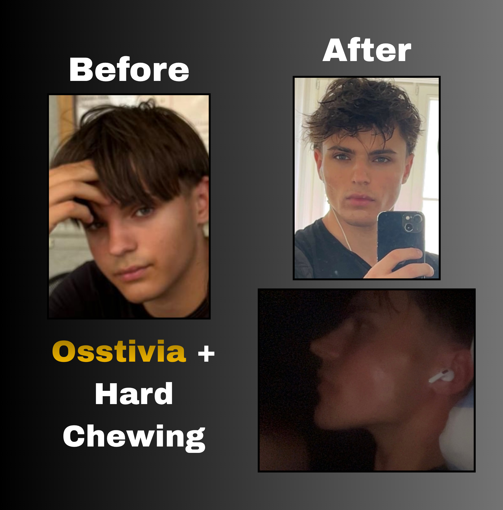 Osstivia SNEDDS Pre-Ordering