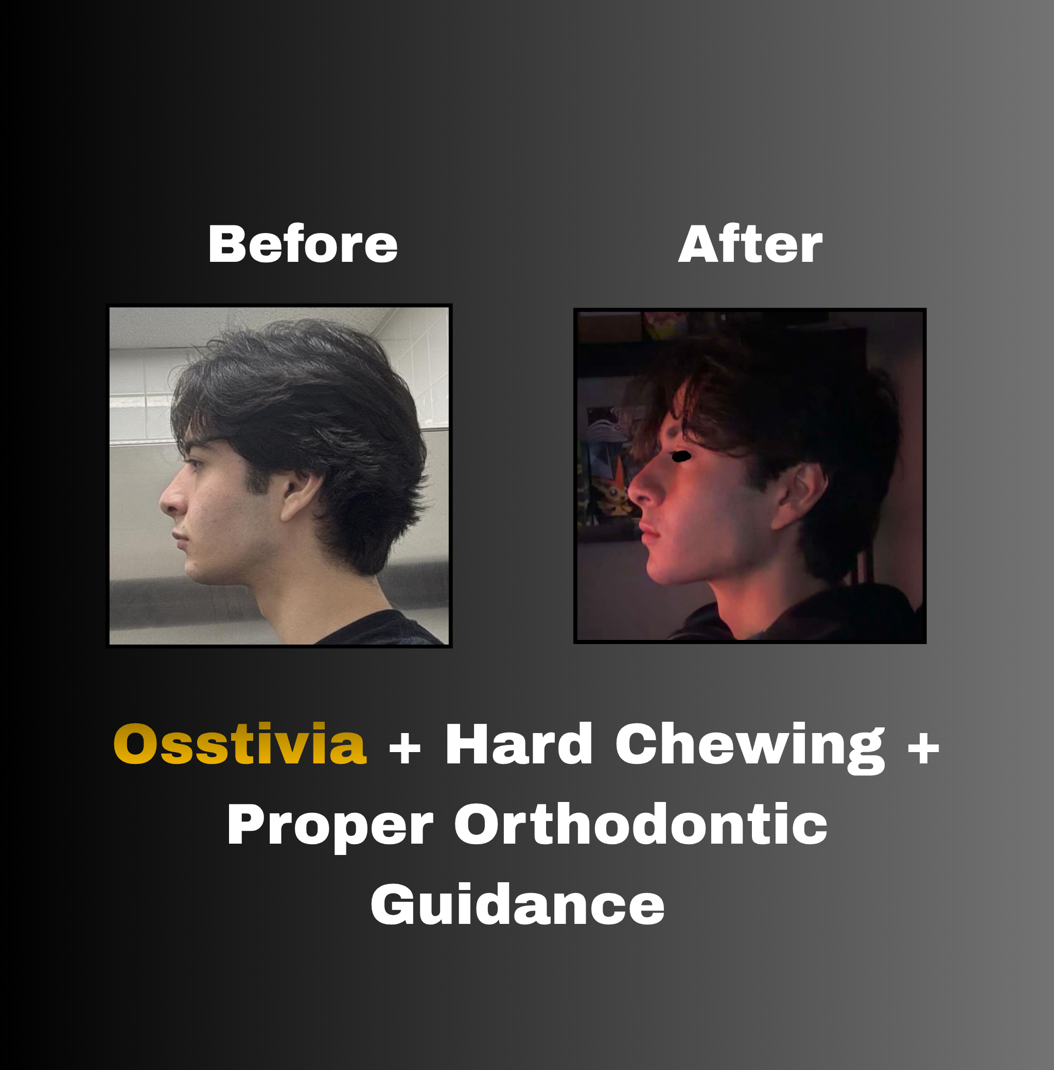 Osstivia SNEDDS