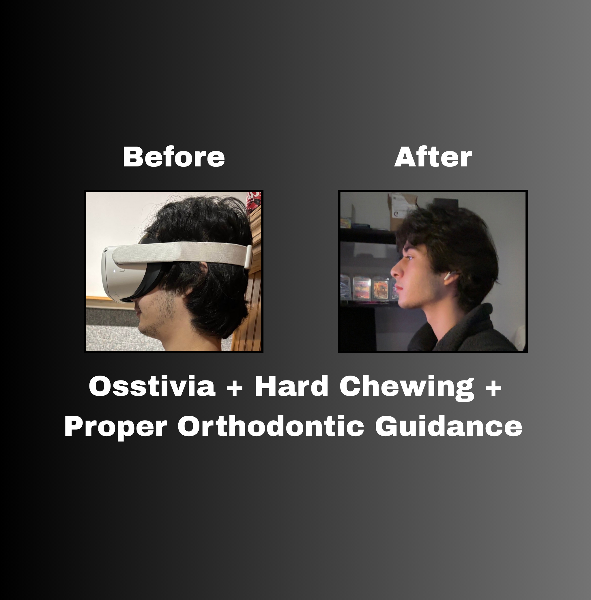 Osstivia SNEDDS Pre-Ordering