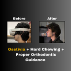 Osstivia SNEDDS Pre-Ordering