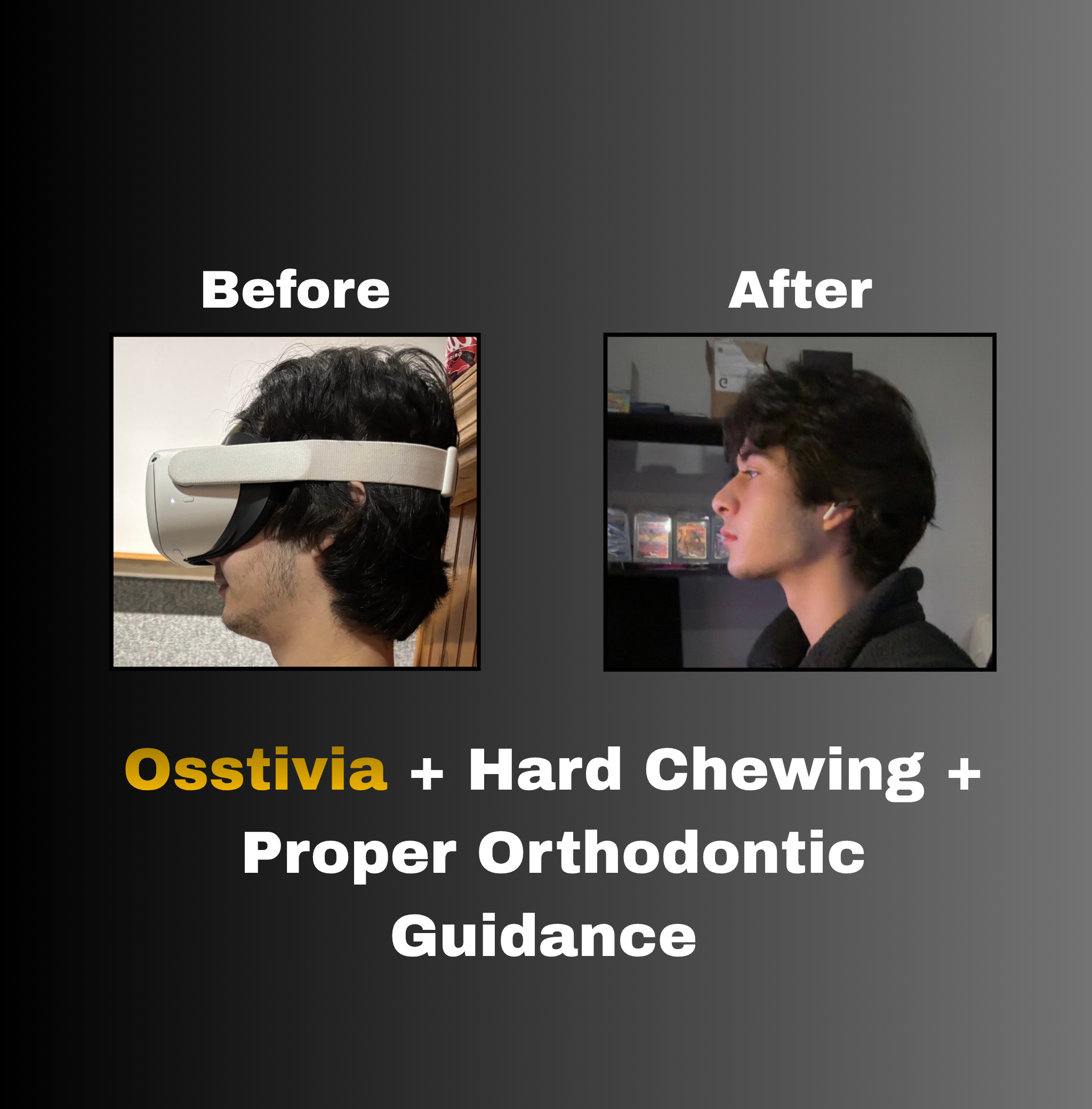 Osstivia SNEDDS