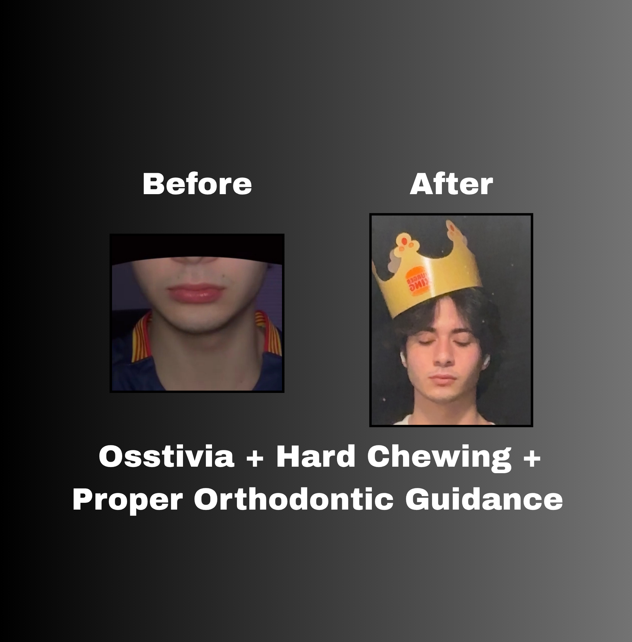 Osstivia SNEDDS Pre-Ordering