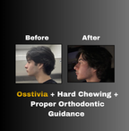 Osstivia SNEDDS Pre-Ordering