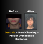 Osstivia SNEDDS Pre-Ordering