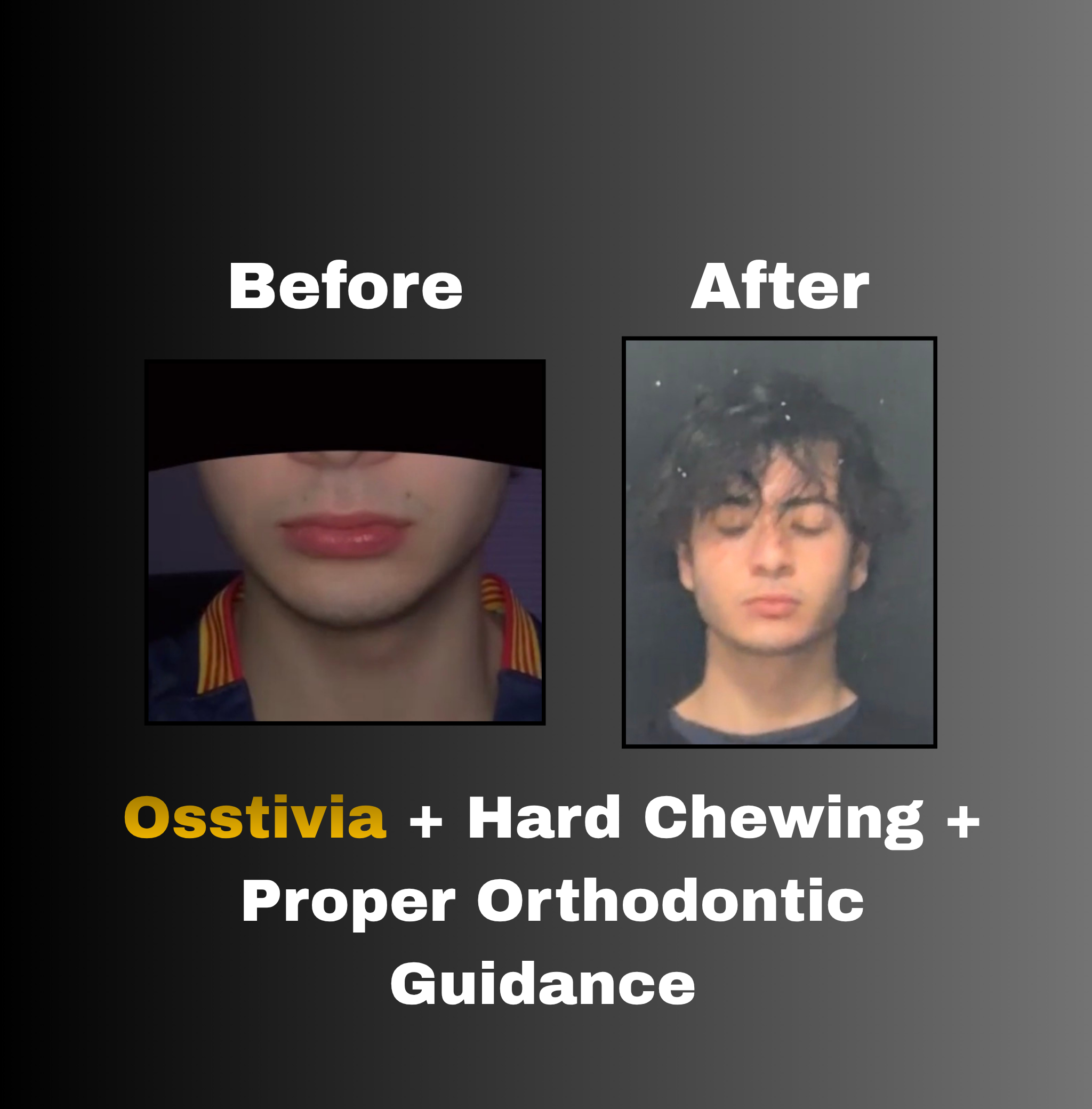 Osstivia SNEDDS
