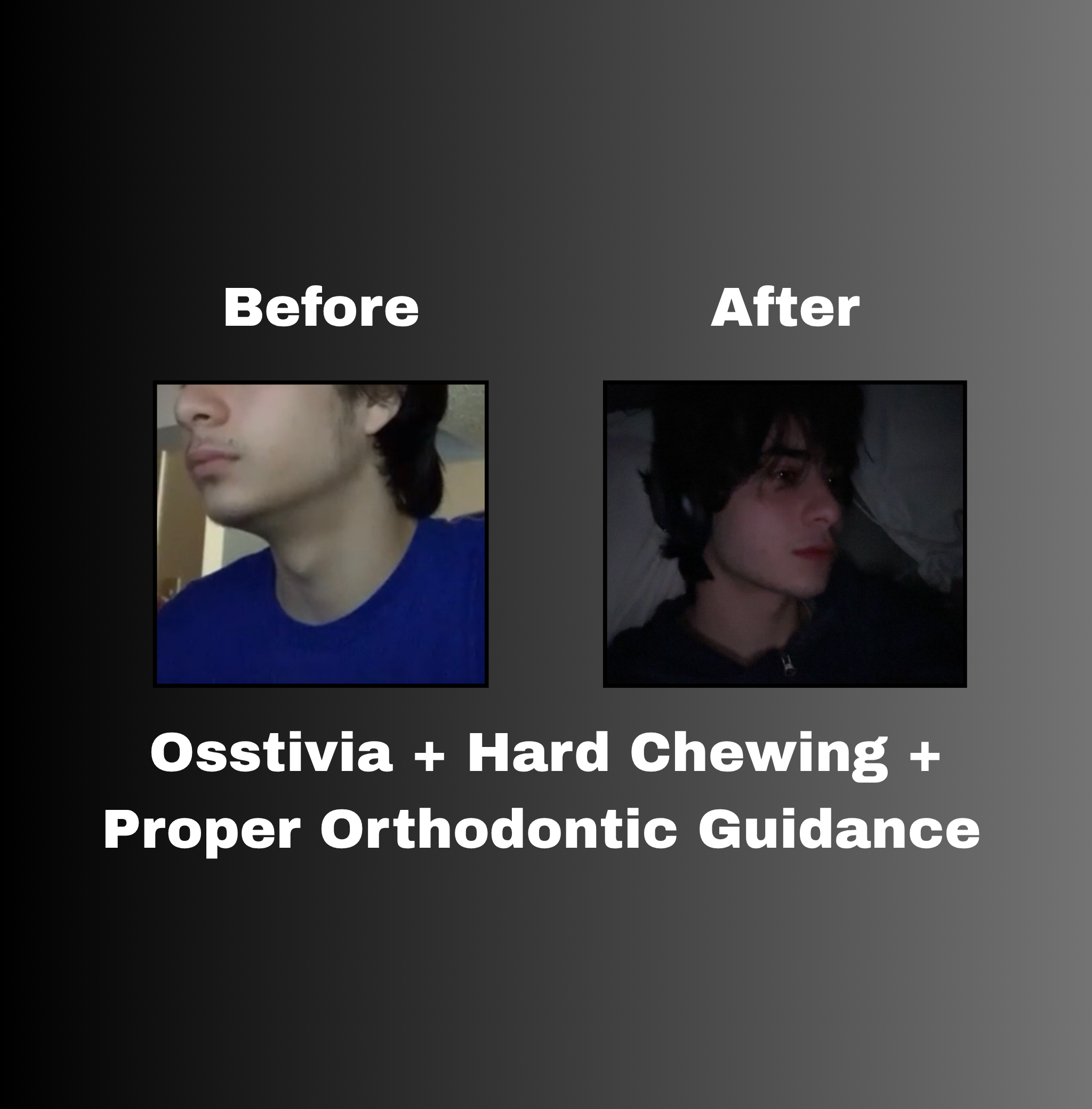Osstivia SNEDDS Pre-Ordering