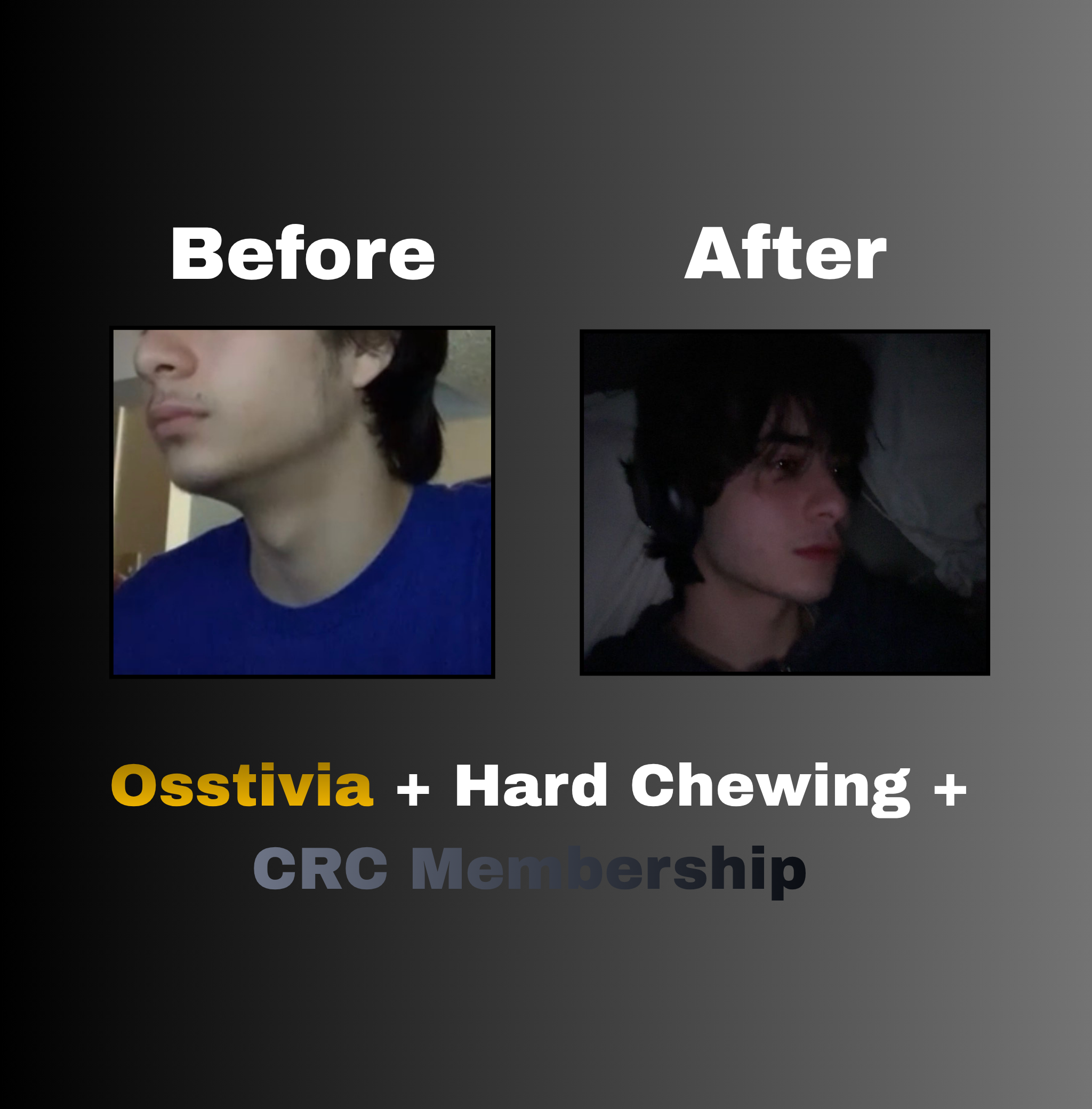 Osstivia SNEDDS Pre-Ordering