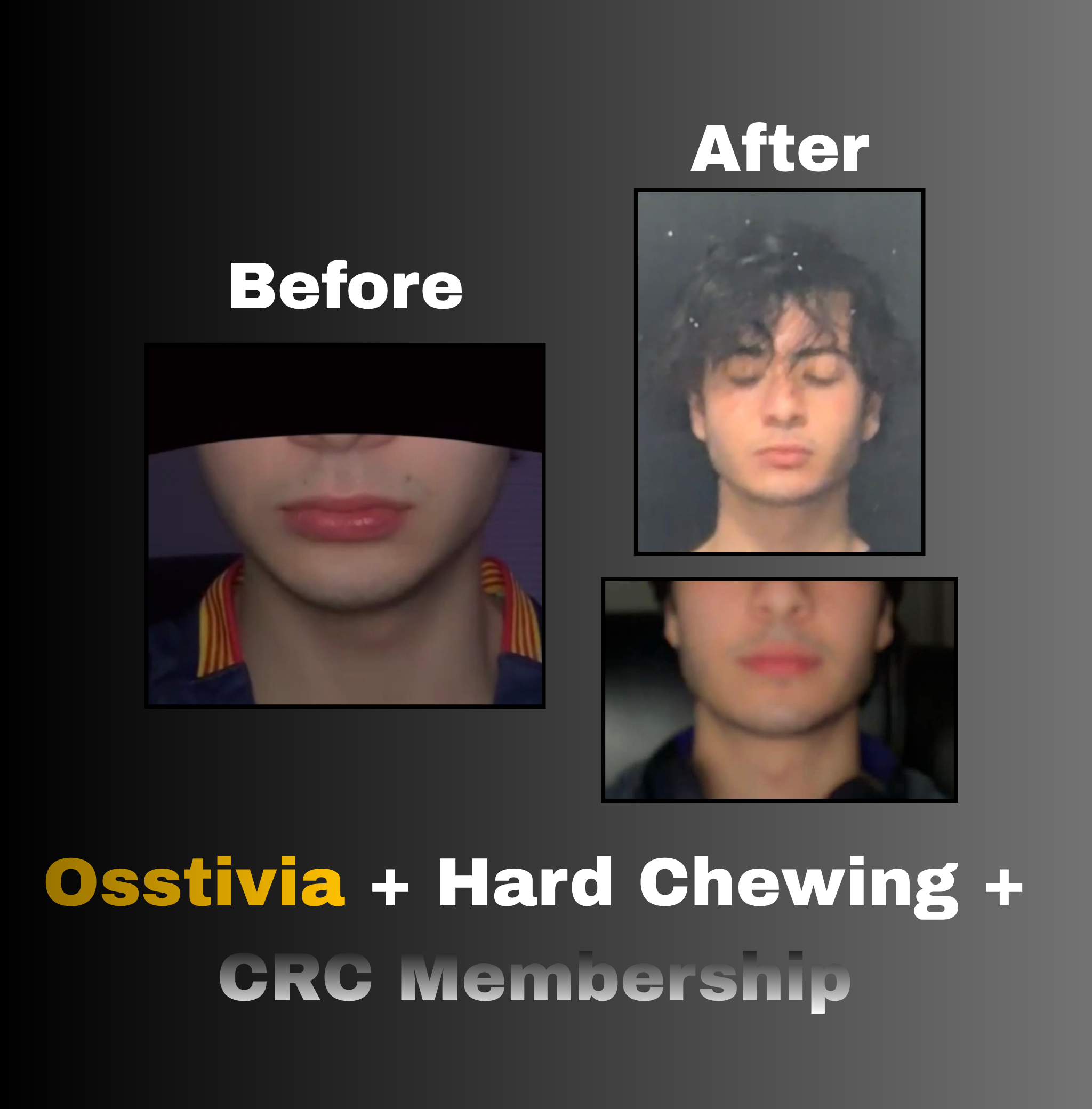 Osstivia SNEDDS Pre-Ordering