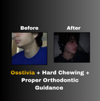 Osstivia SNEDDS Pre-Ordering