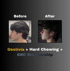 Osstivia SNEDDS Pre-Ordering