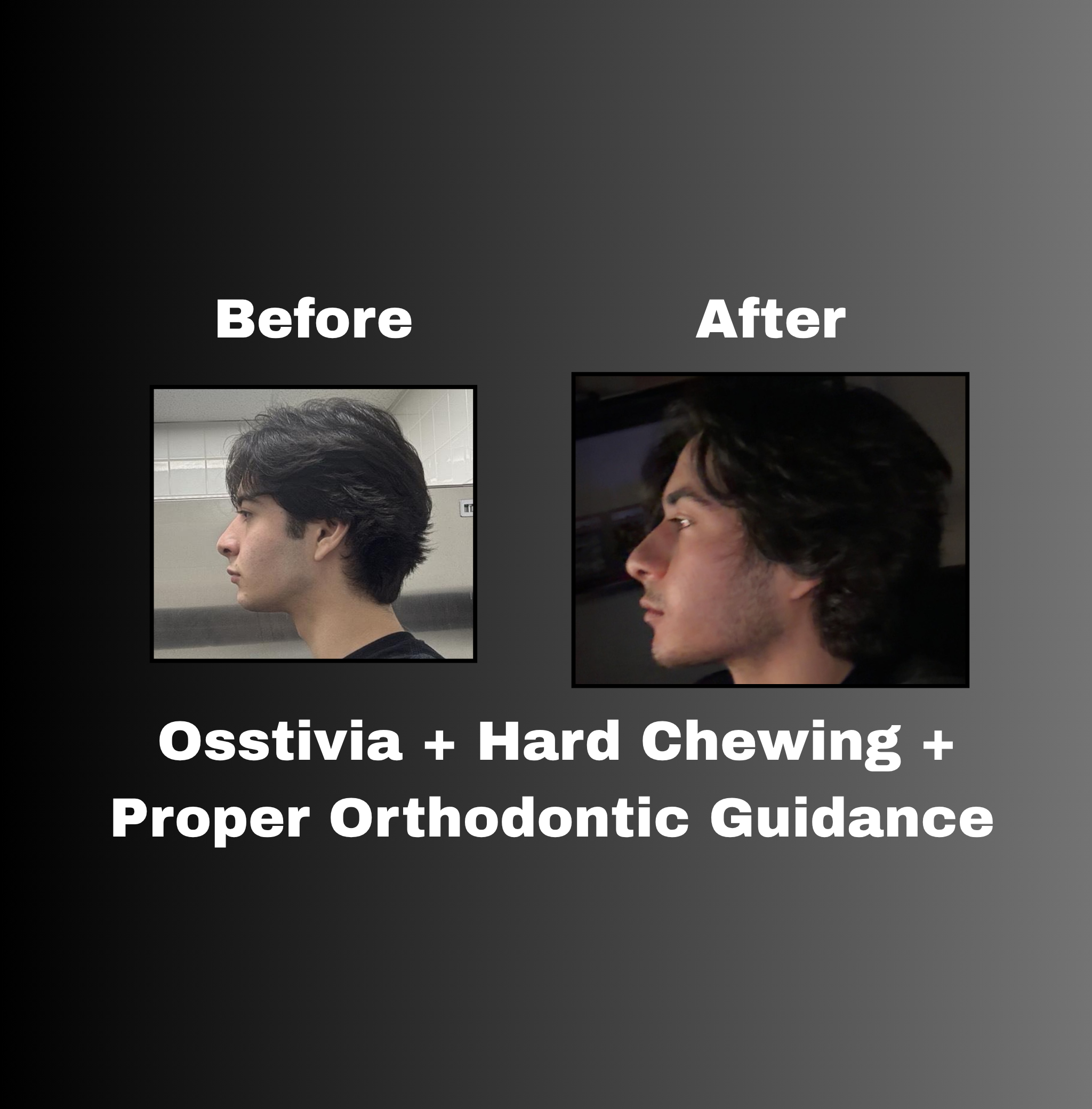 Osstivia SNEDDS Pre-Ordering