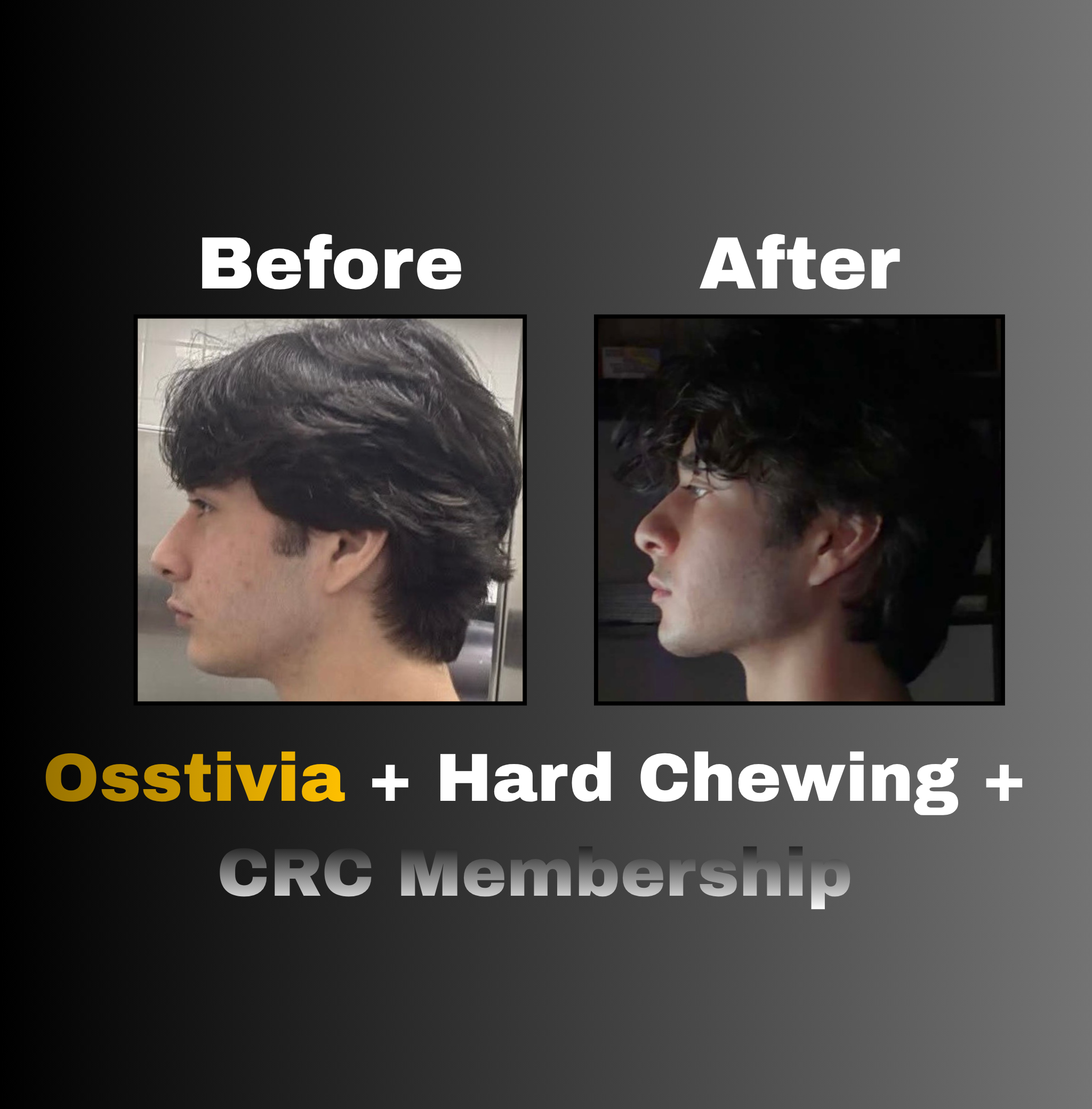 Osstivia SNEDDS Pre-Ordering