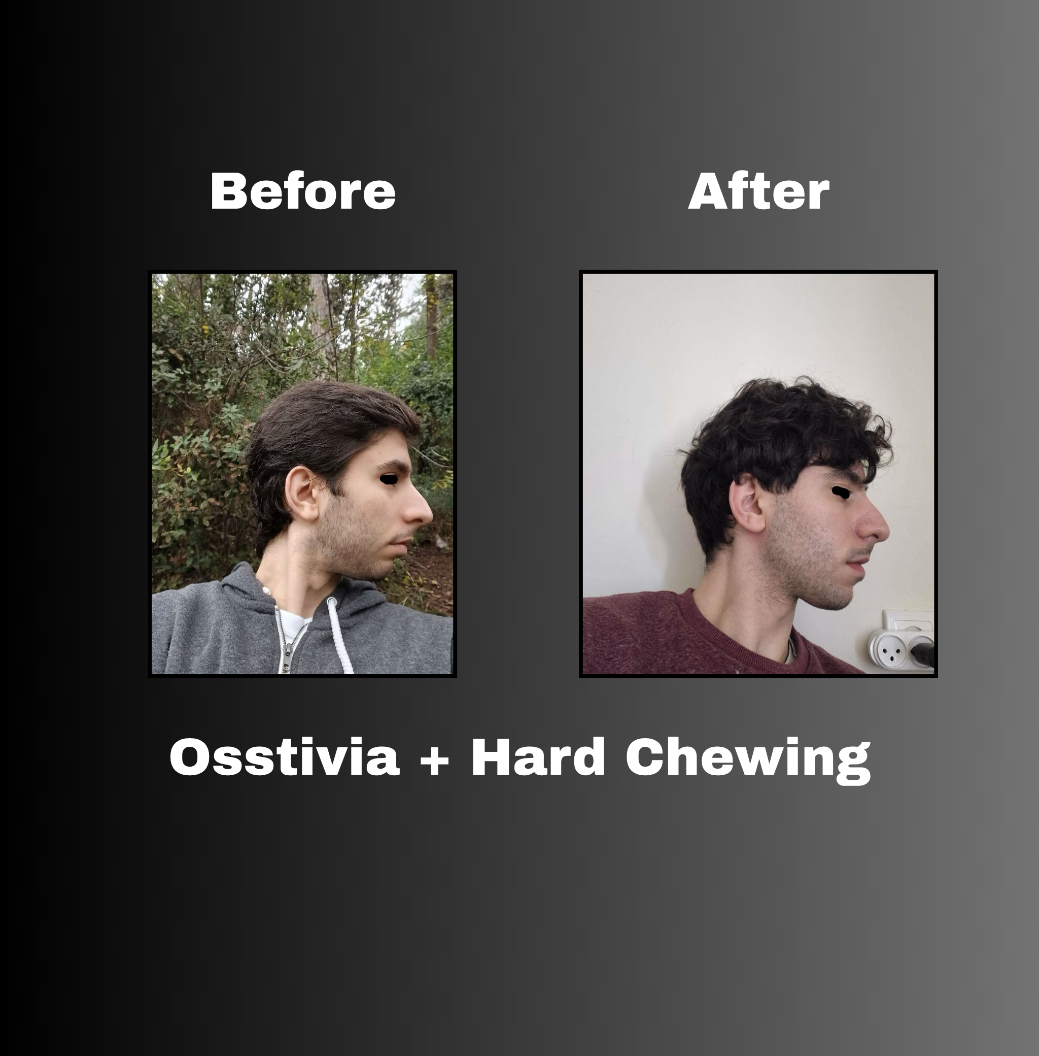 Osstivia SNEDDS Pre-Ordering