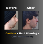 Osstivia SNEDDS Pre-Ordering