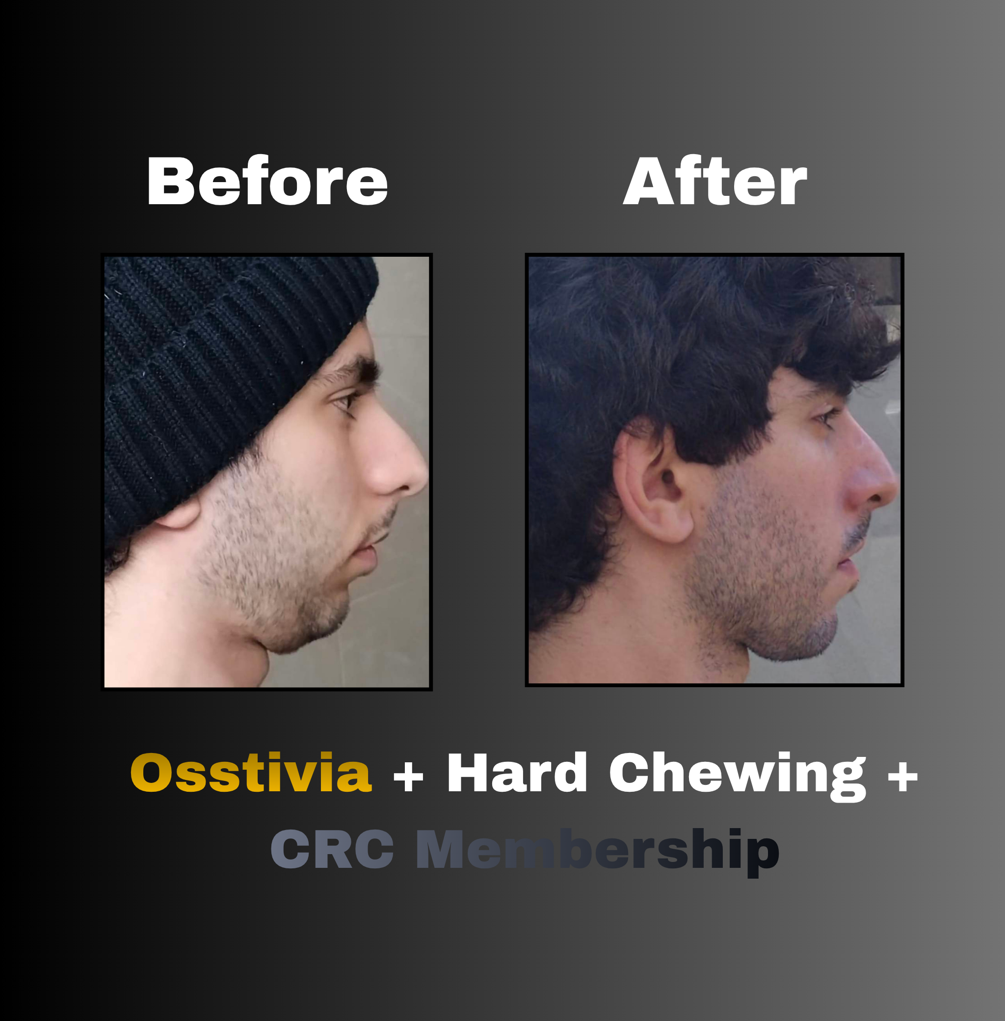 Osstivia SNEDDS Pre-Ordering