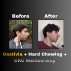 Osstivia SNEDDS Pre-Ordering