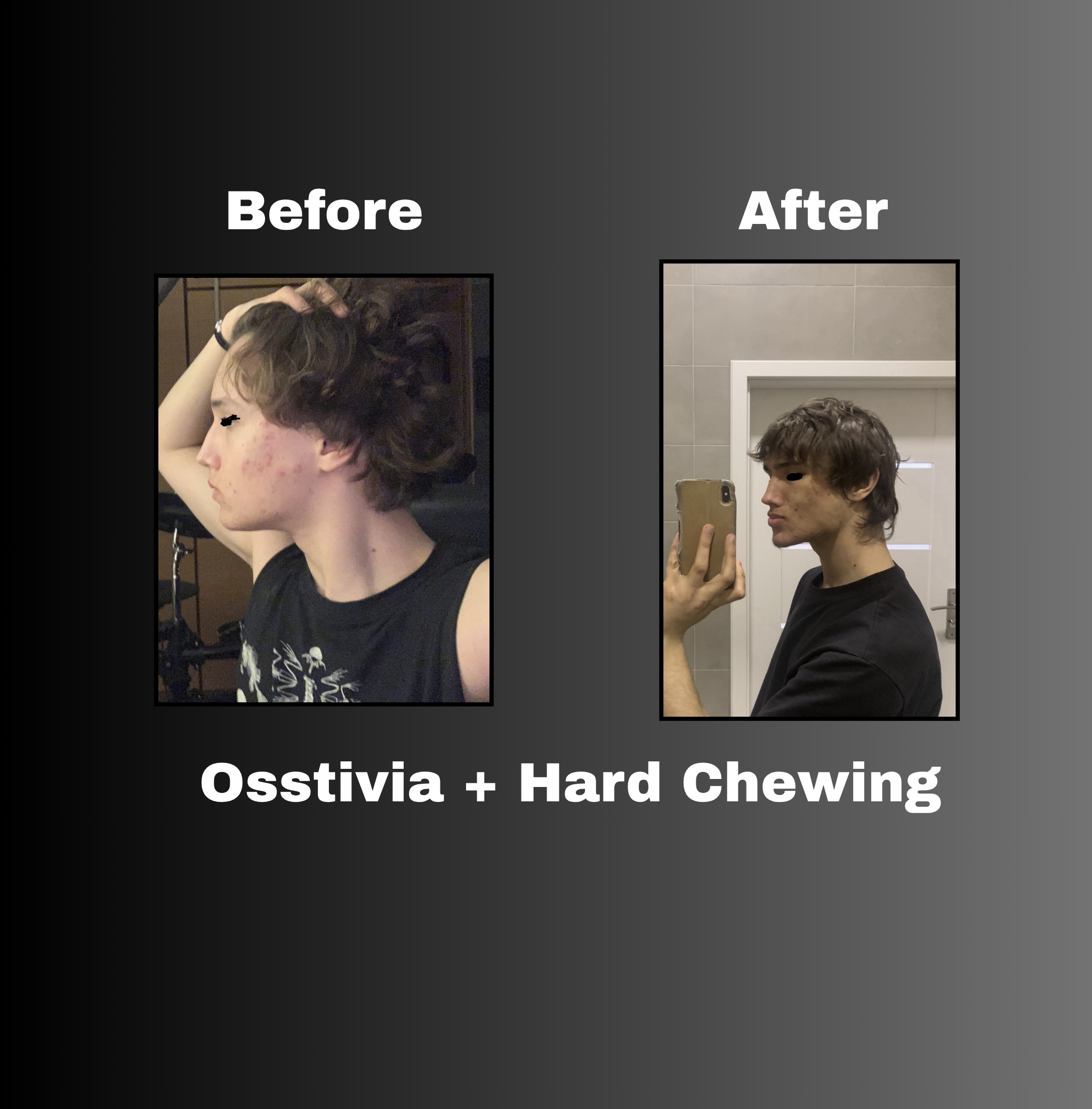 Osstivia SNEDDS Pre-Ordering