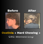 Osstivia SNEDDS Pre-Ordering