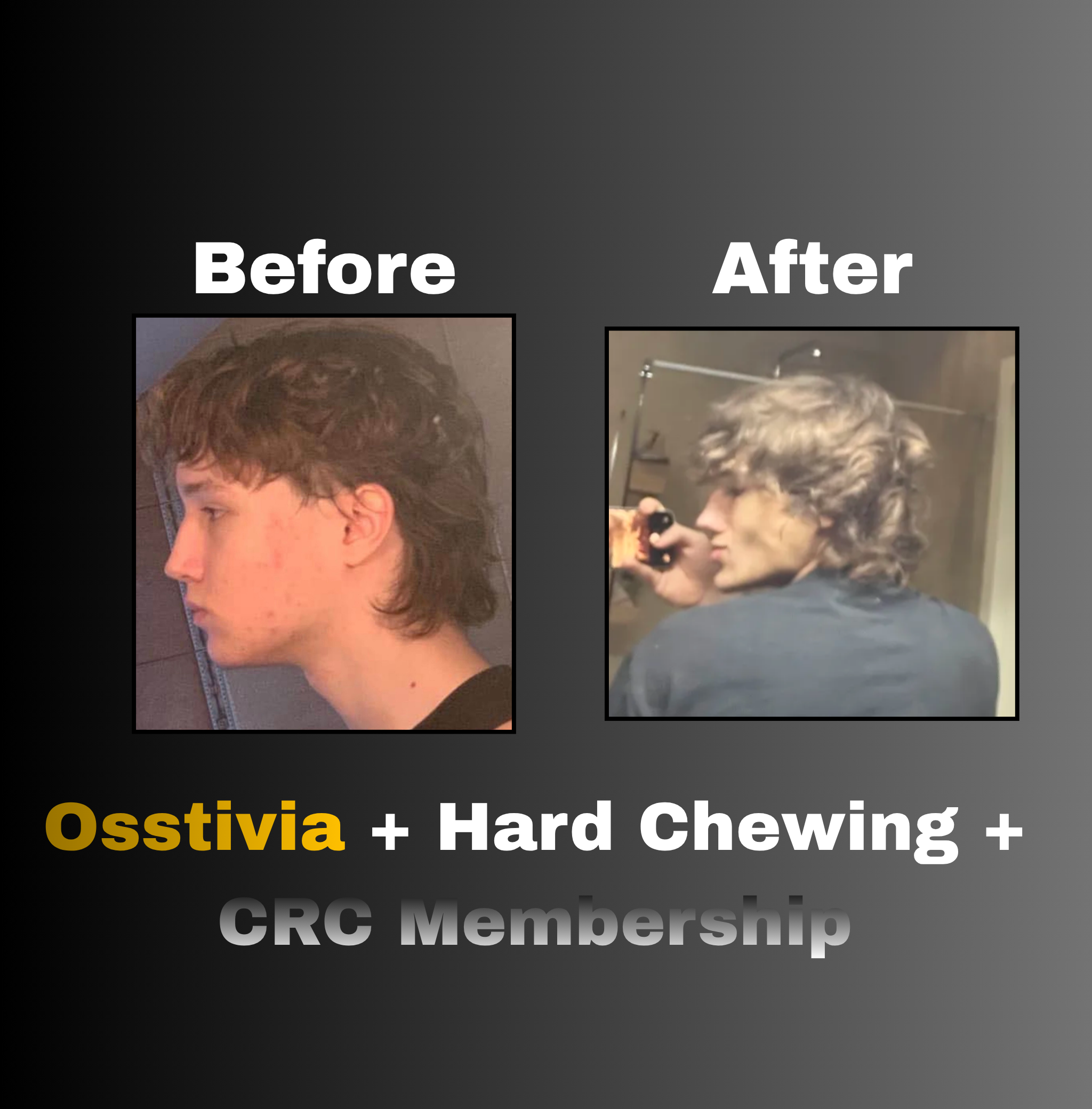 Osstivia SNEDDS Pre-Ordering