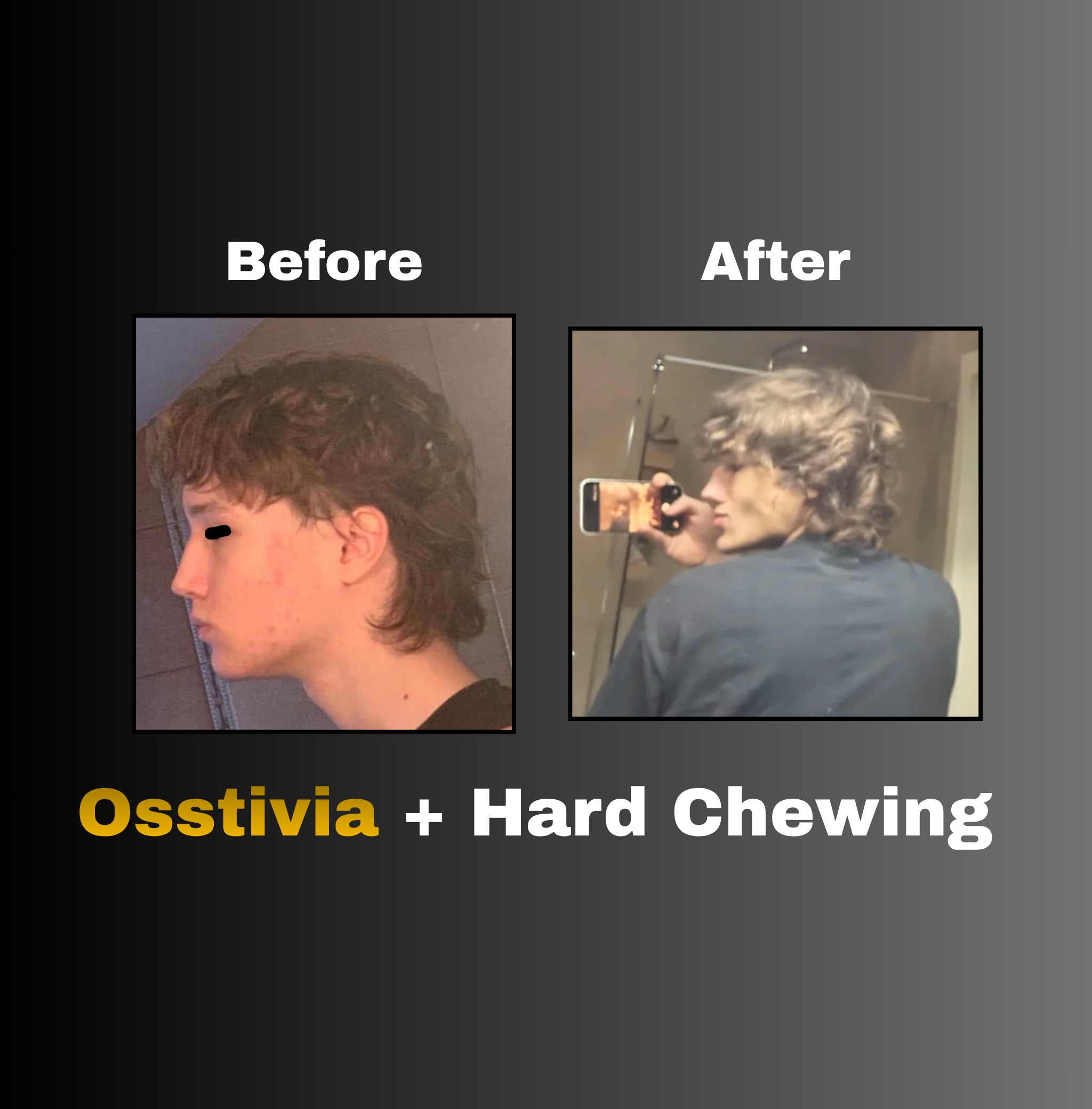 Osstivia SNEDDS Pre-Ordering