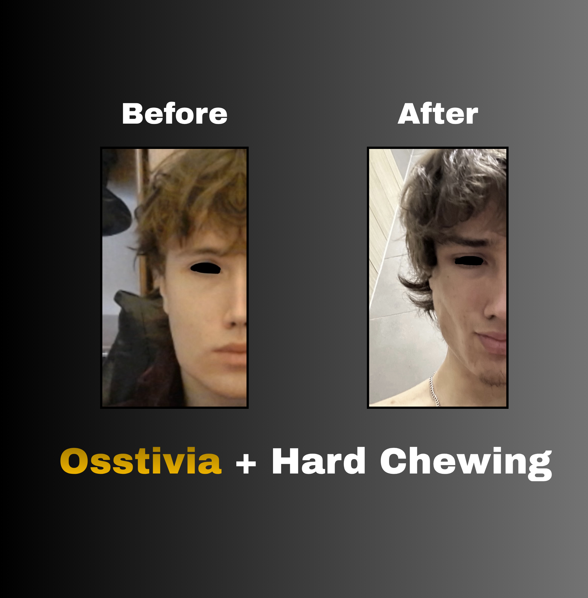 Osstivia SNEDDS