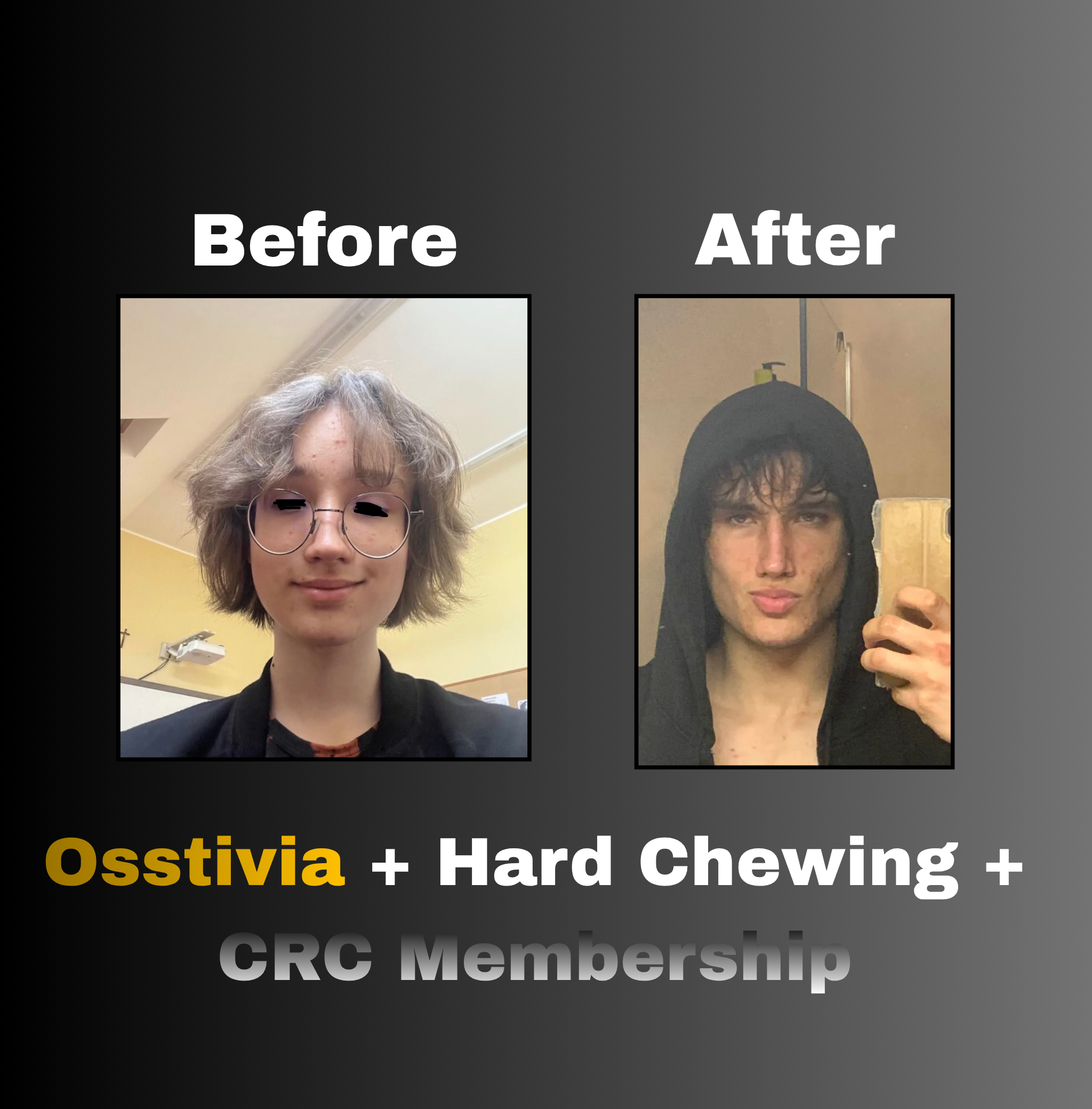 Osstivia SNEDDS Pre-Ordering