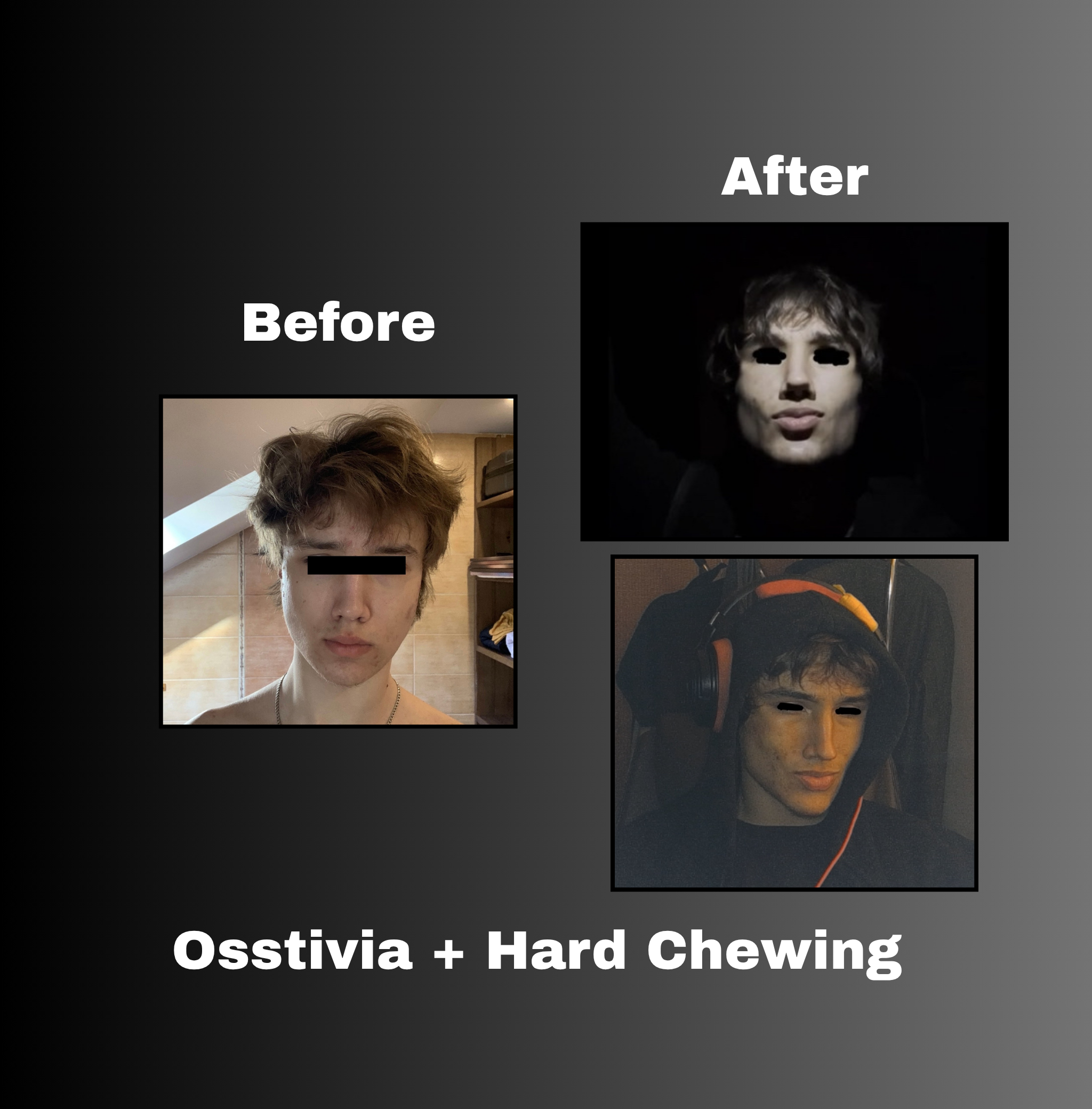 Osstivia SNEDDS Pre-Ordering