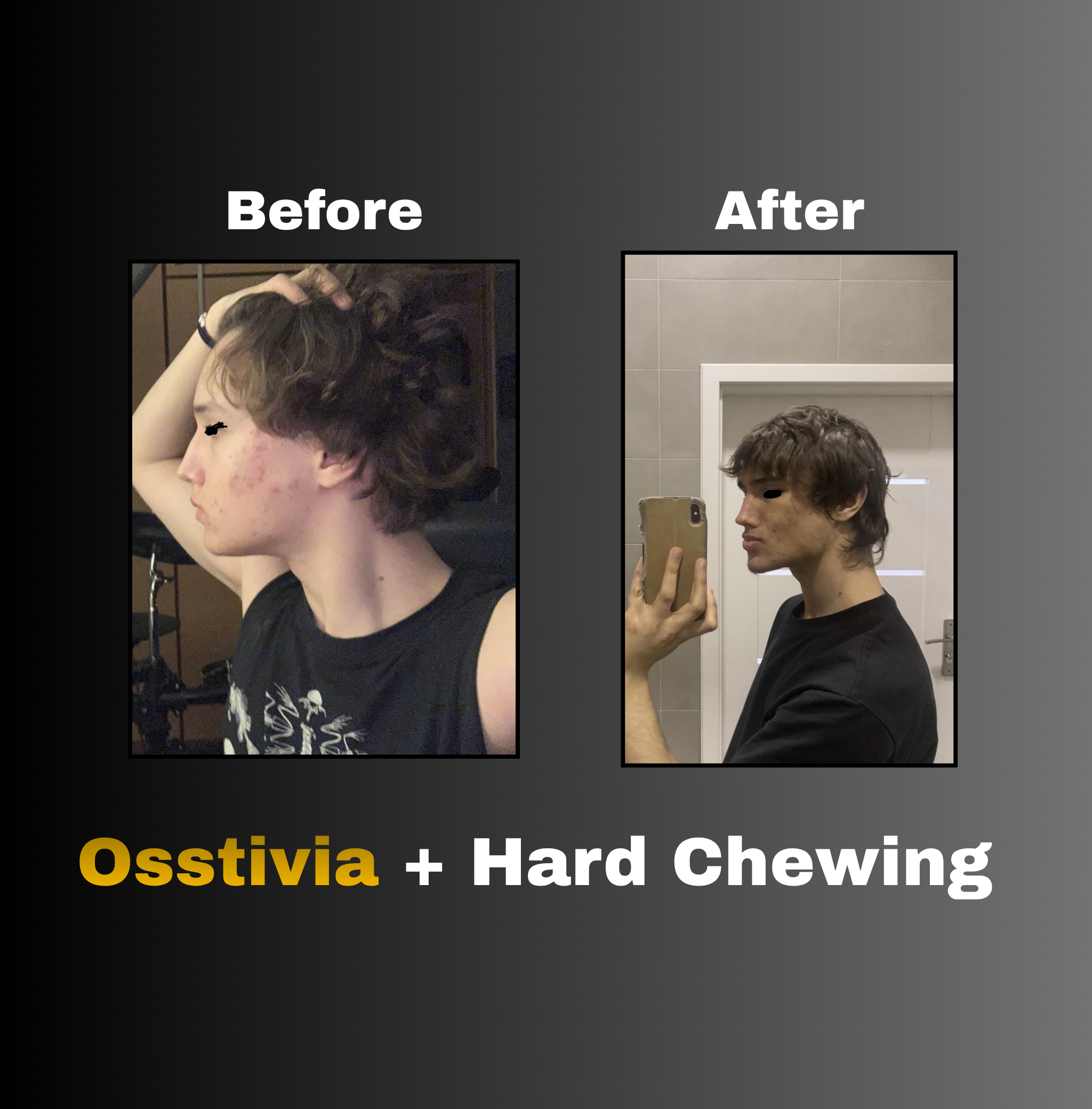 Osstivia SNEDDS