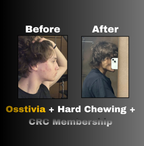 Osstivia SNEDDS Pre-Ordering