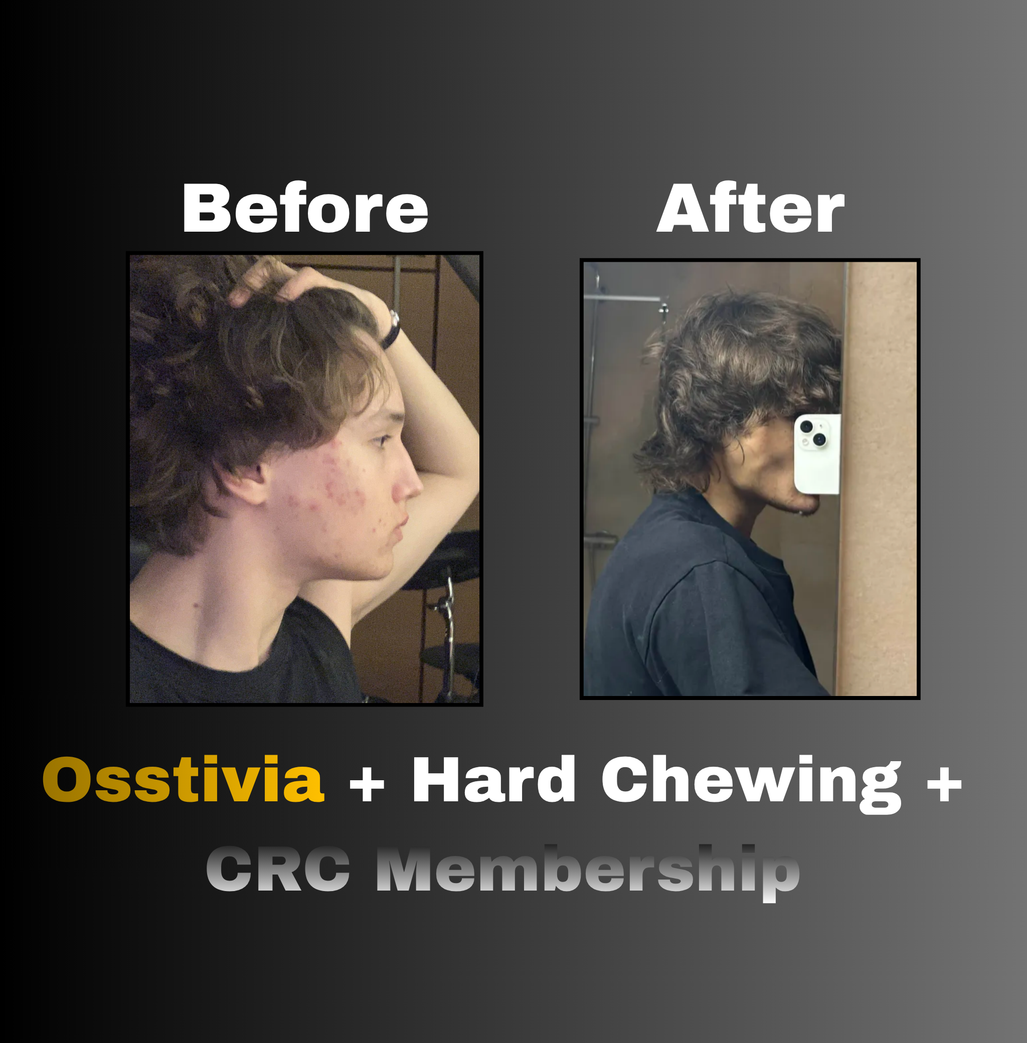 Osstivia SNEDDS Pre-Ordering
