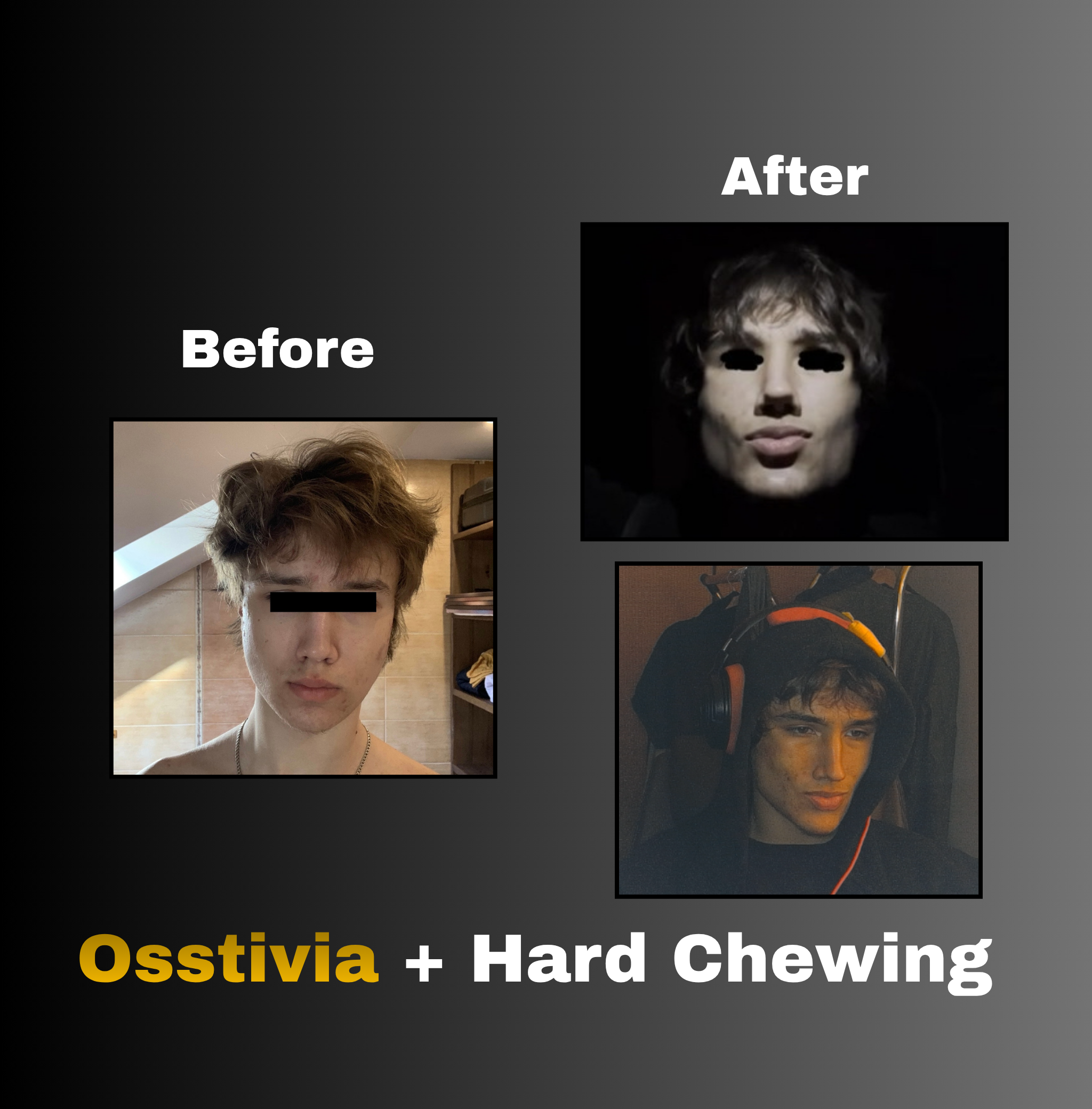 Osstivia SNEDDS