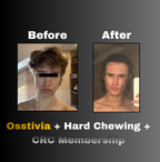 Osstivia SNEDDS (Legacy)