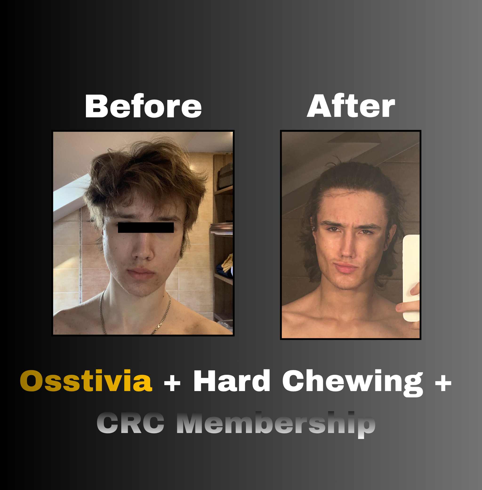Osstivia SNEDDS (Legacy)