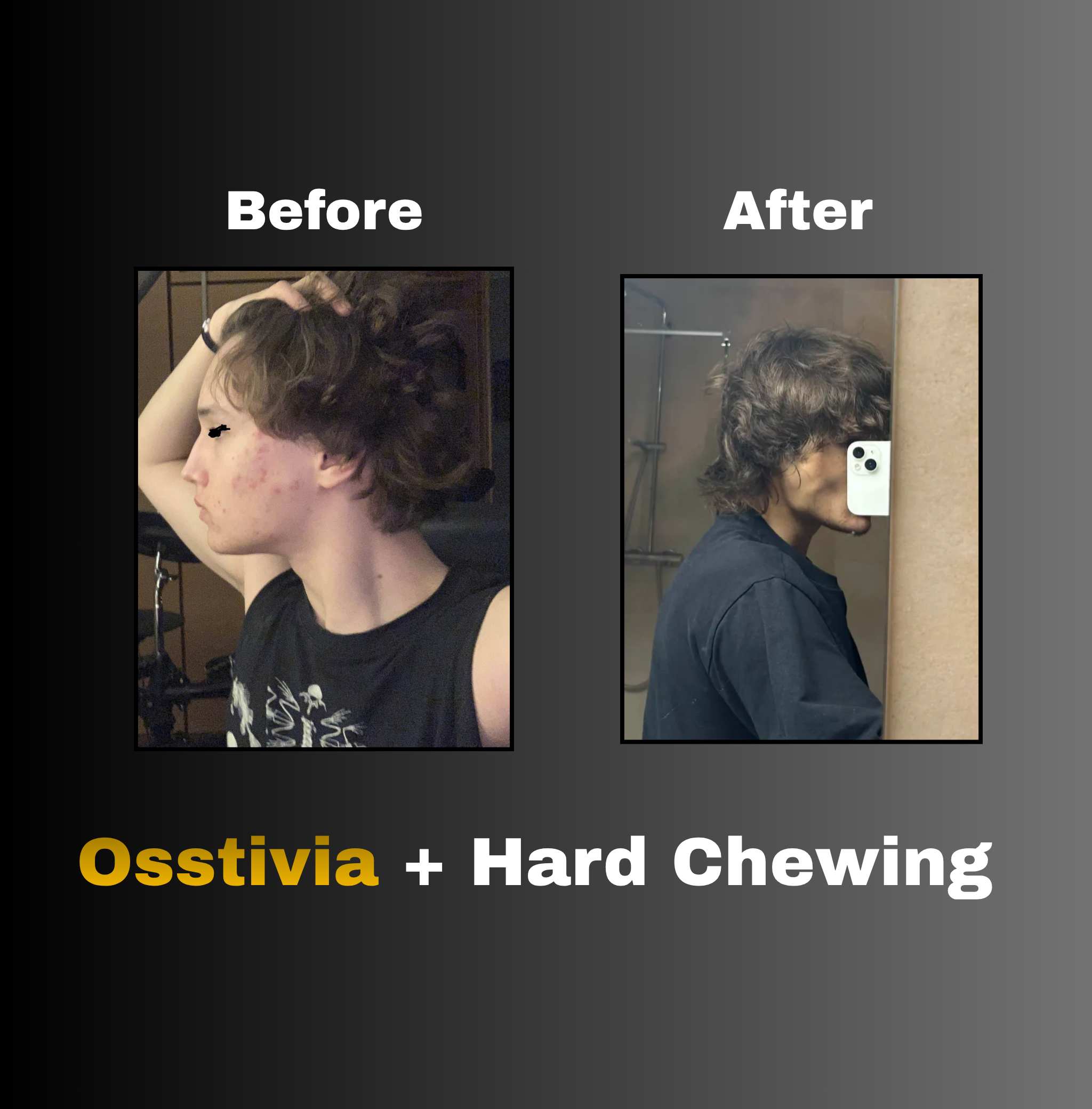 Osstivia SNEDDS Pre-Ordering