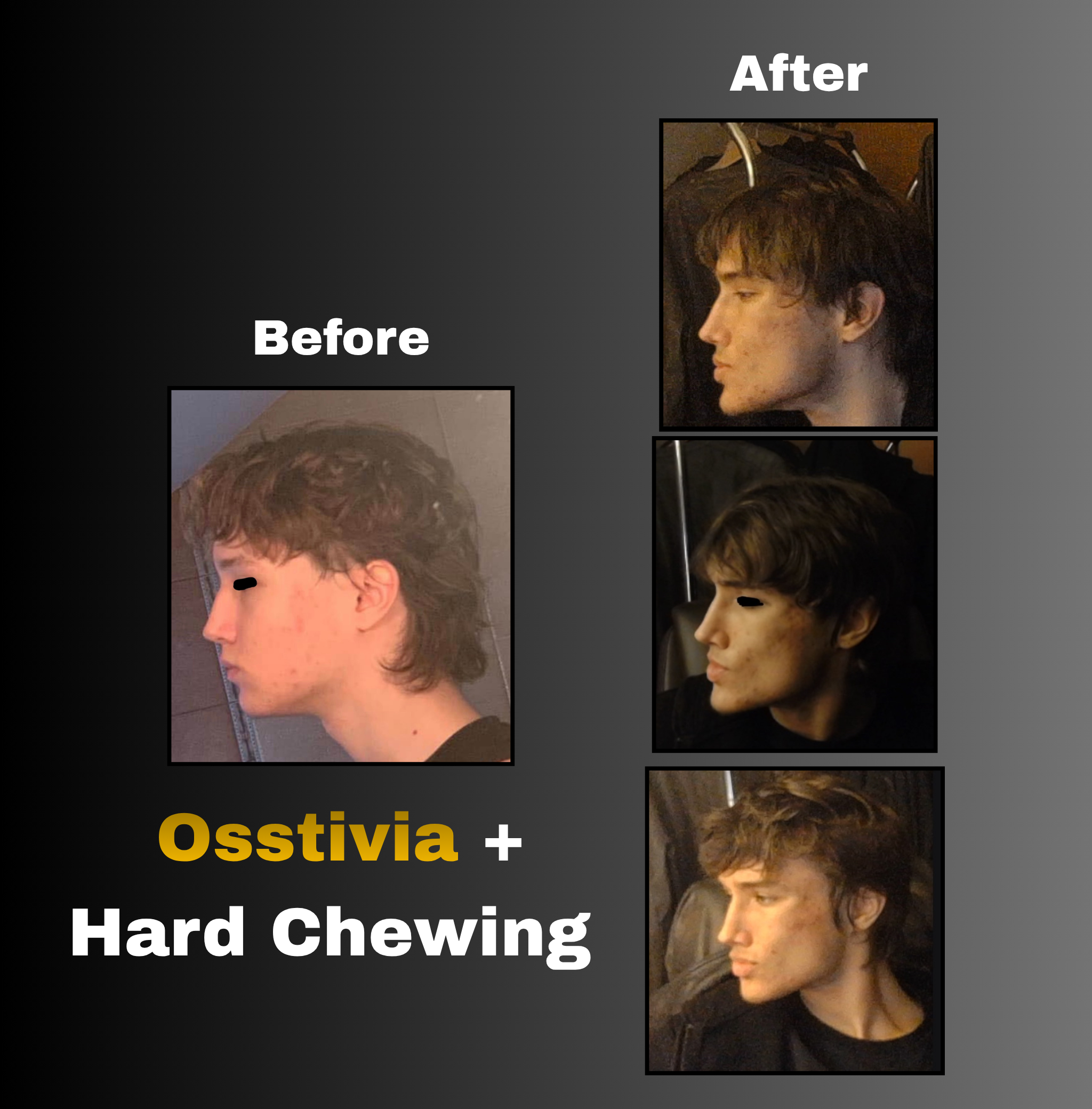 Osstivia SNEDDS Pre-Ordering