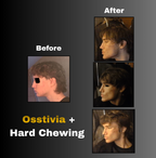 Osstivia SNEDDS Pre-Ordering
